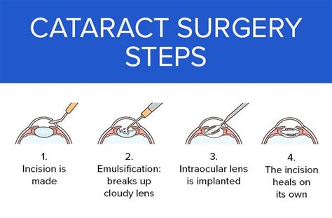 Huddersfield: 10 expert Ophthalmologists for cataract surgery.